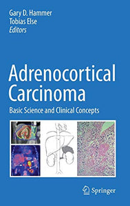 Adrenocortical Carcinoma