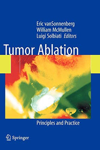 Tumor Ablation