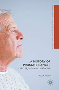 A History of Prostate Cancer