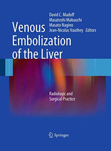 Venous Embolization of the Liver