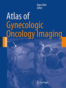 Atlas of Gynecologic Oncology Imaging