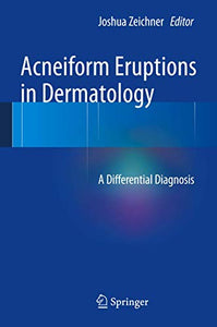 Acneiform Eruptions in Dermatology