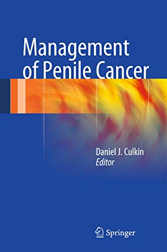 Management of Penile Cancer