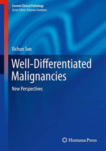 Well-Differentiated Malignancies