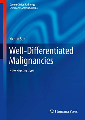 Well-Differentiated Malignancies