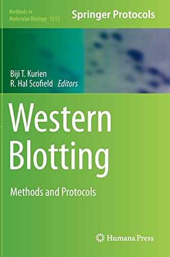 Western Blotting