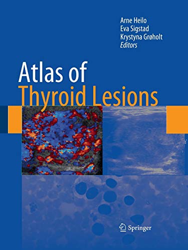 Atlas of Thyroid Lesions