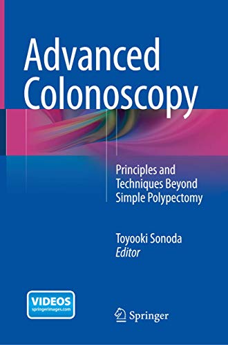 Advanced Colonoscopy