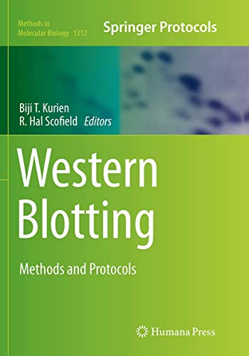 Western Blotting