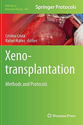 Xenotransplantation