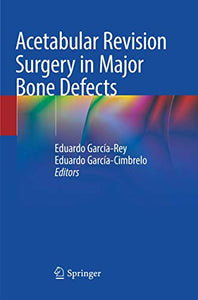 Acetabular Revision Surgery in Major Bone Defects