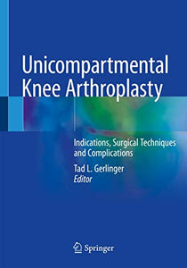 Unicompartmental Knee Arthroplasty