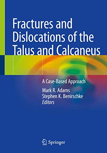 Fractures and Dislocations of the Talus and Calcaneus