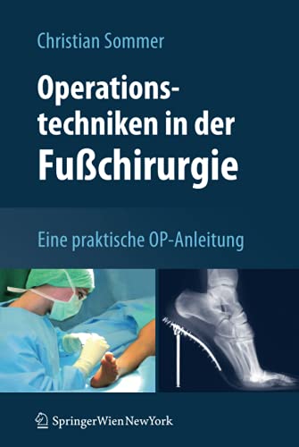 Operationstechniken in der Fußchirurgie