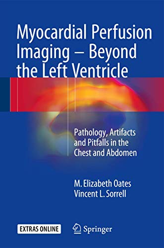 Myocardial Perfusion Imaging - Beyond the Left Ventricle