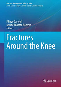 Fractures Around the Knee