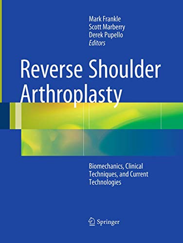 Reverse Shoulder Arthroplasty