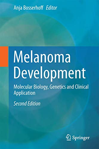 Melanoma Development