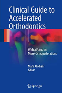 Clinical Guide to Accelerated Orthodontics