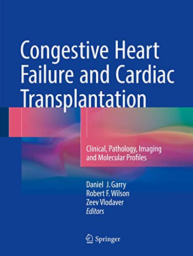 Congestive Heart Failure and Cardiac Transplantation