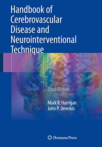 Handbook of Cerebrovascular Disease and Neurointerventional Technique