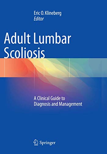 Adult Lumbar Scoliosis