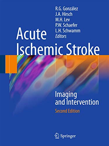 Acute Ischemic Stroke