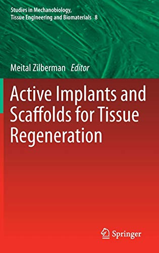 Active Implants and Scaffolds for Tissue Regeneration