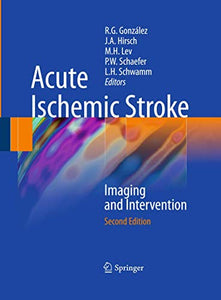 Acute Ischemic Stroke