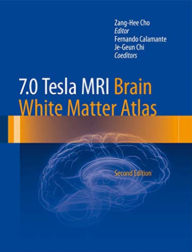 7.0 Tesla MRI Brain White Matter Atlas