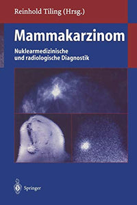 Mammakarzinom