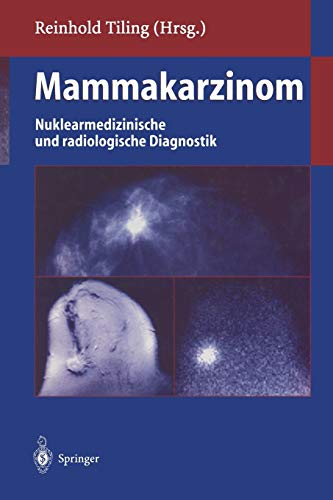 Mammakarzinom