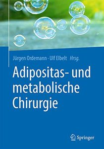 Adipositas- und metabolische Chirurgie