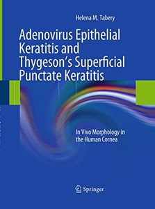 Adenovirus Epithelial Keratitis and Thygeson's Superficial Punctate Keratitis