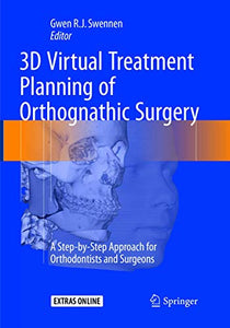 3D Virtual Treatment Planning of Orthognathic Surgery