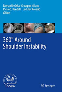 360° Around Shoulder Instability