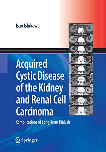 Acquired Cystic Disease of the Kidney and Renal Cell Carcinoma