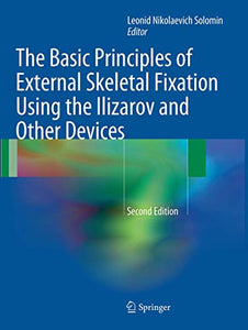 The Basic Principles of External Skeletal Fixation Using the Ilizarov and Other Devices