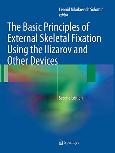 The Basic Principles of External Skeletal Fixation Using the Ilizarov and Other Devices