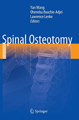 Spinal Osteotomy