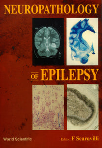 Neuropathology Of Epilepsy