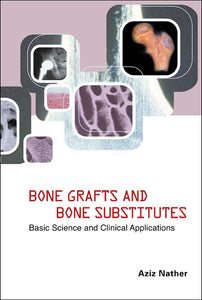 Bone Grafts And Bone Substitutes: Basic Science And Clinical Applications