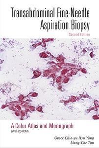 Transabdominal Fine-needle Aspiration Biopsy (2nd Edition): A Color Atlas And Monograph (With Cd-rom)