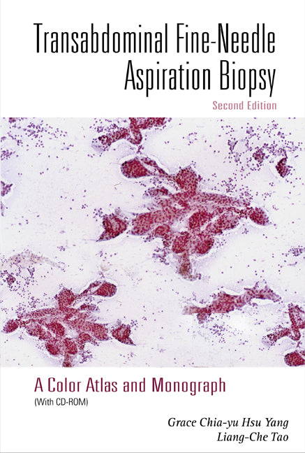 Transabdominal Fine-needle Aspiration Biopsy (2nd Edition): A Color Atlas And Monograph (With Cd-rom)