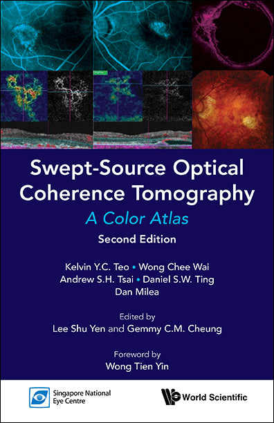 Swept-source Optical Coherence Tomography: A Color Atlas (Second Edition)