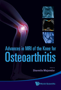 Advances In Mri Of The Knee For Osteoarthritis