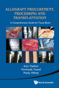 Allograft Procurement, Processing And Transplantation: A Comprehensive Guide For Tissue Banks