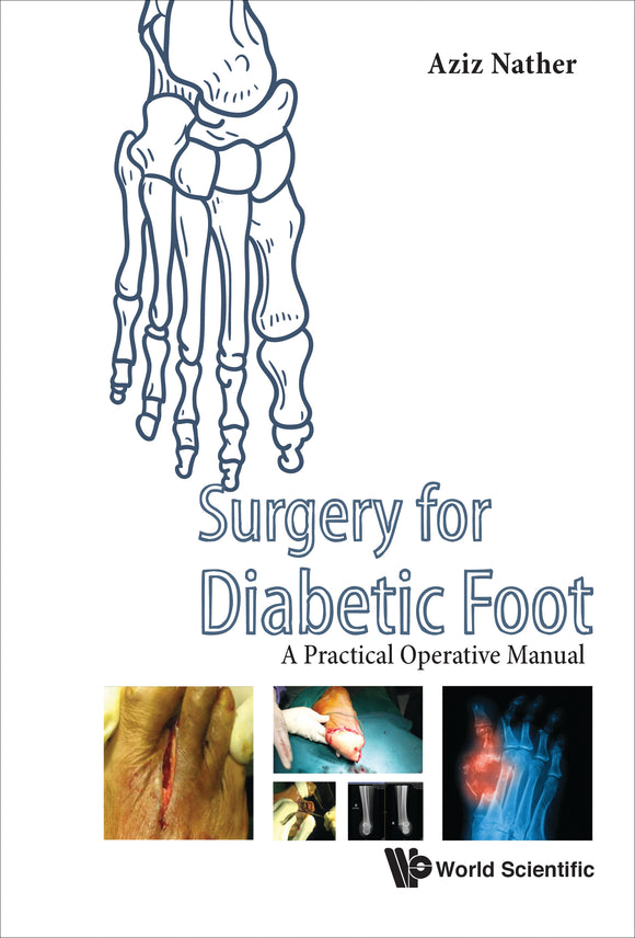 Surgery For Diabetic Foot: A Practical Operative Manual