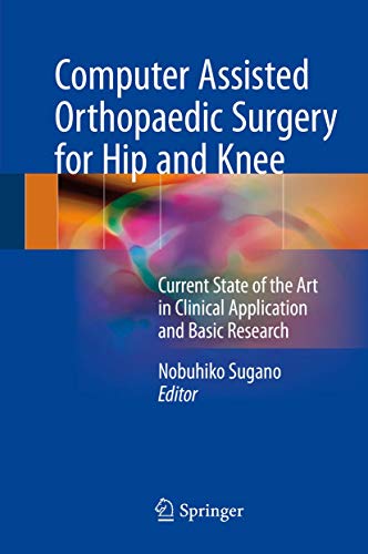 Computer Assisted Orthopaedic Surgery for Hip and Knee