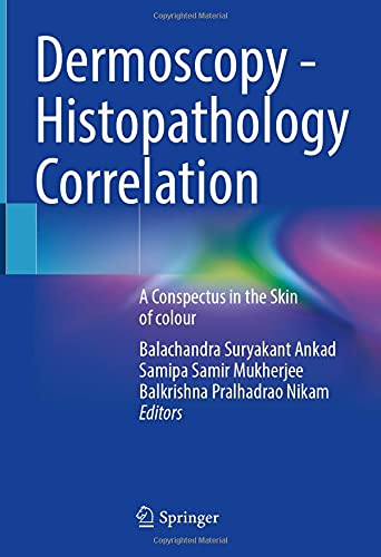 Dermoscopy - Histopathology Correlation